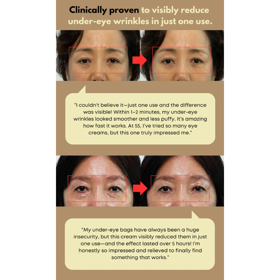 [PRE ORDER] NINE LESS Ever Youth Dual Effect Eye Cream 20ml