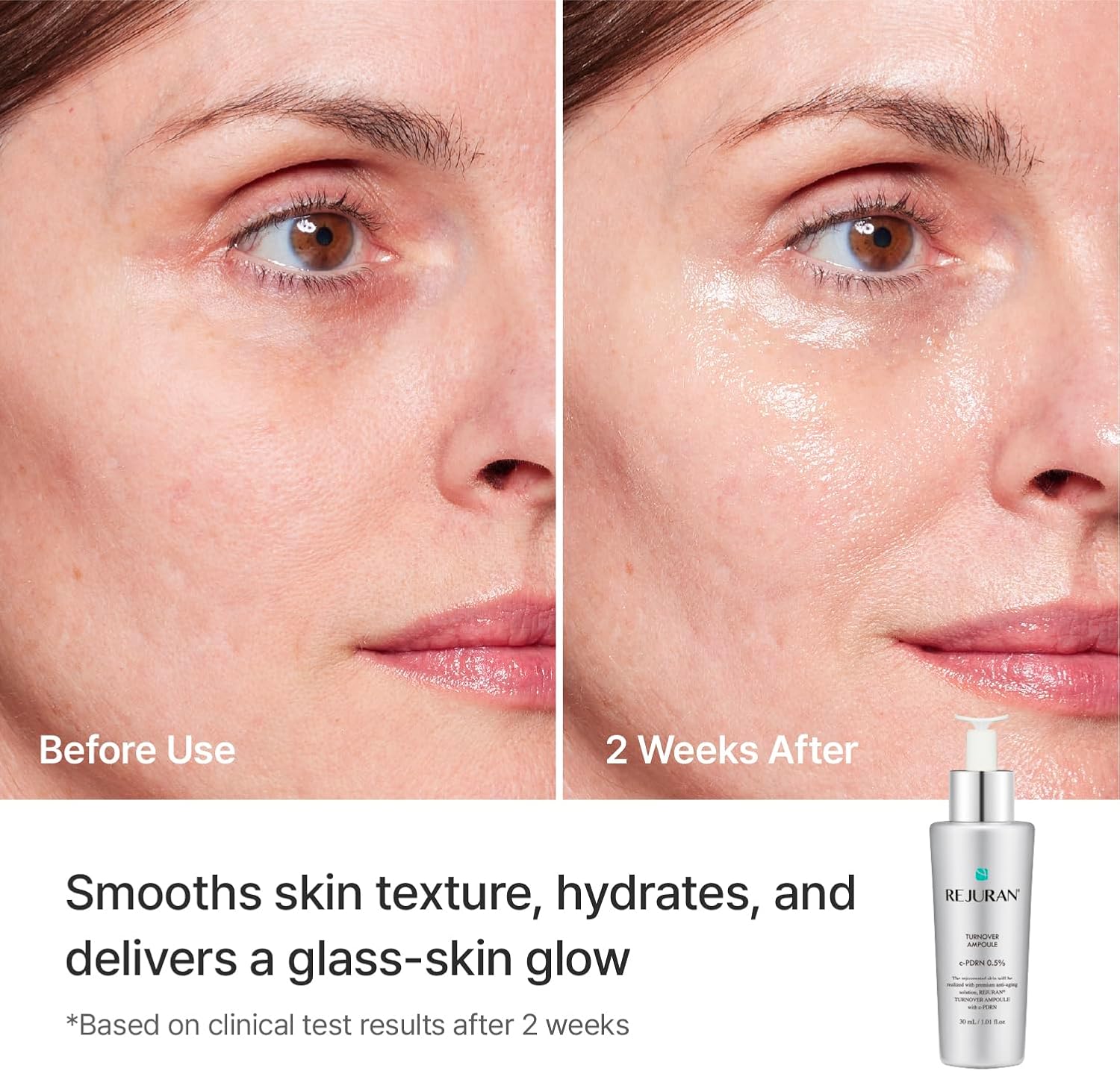 [PRE ORDER] BOGO Rejuran Turnover Ampoule 30ml