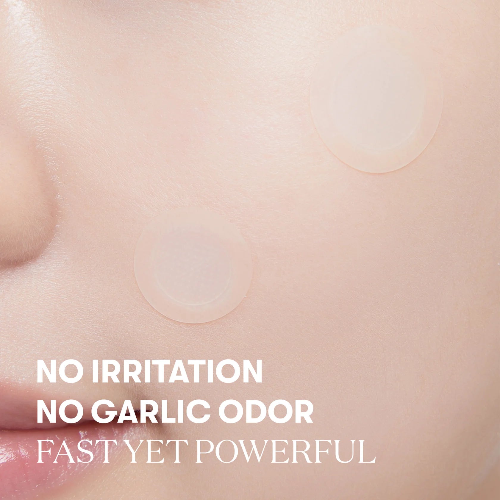 [PRE ORDER] VT COSMETICS Garlic AC Reedle Shot Point Patch
