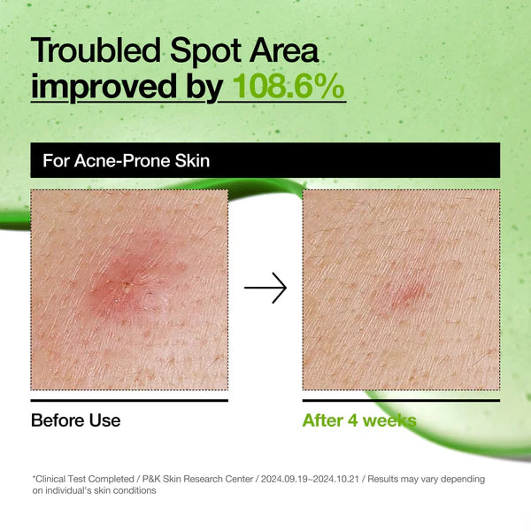 [PRE ORDER] ANUA Azelaic Acid 10 Hyaluron Redness Soothing Serum 30ml