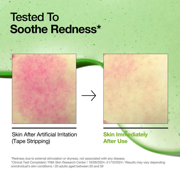 [PRE ORDER] ANUA Azelaic Acid 10 Hyaluron Redness Soothing Serum 30ml