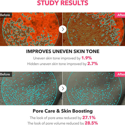 APRILSKIN TXA Niacinamide Toning Shot 99 Serum 30ml