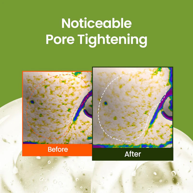 BEPLAIN Mungbean Pore Tight-Up Serum 30ml