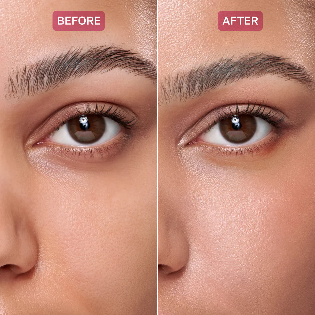 BY JUCCY Gooseberry Dark Circle Brightening Eye Cream 30ml