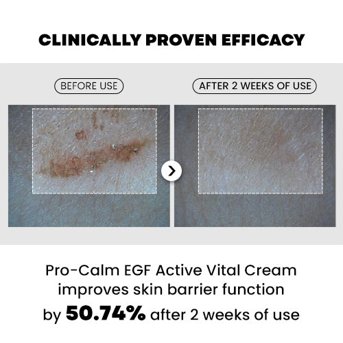HANMI-PRO CALM EGF Active Vital Cream 20ml