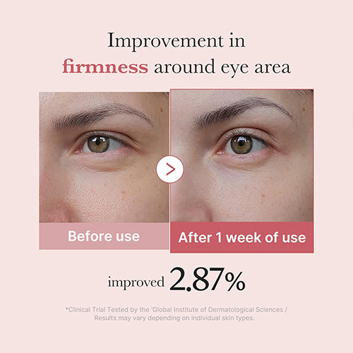 [PRE ORDER] MEDICUBE PDRN Pink Peptide Eye Cream 30ml