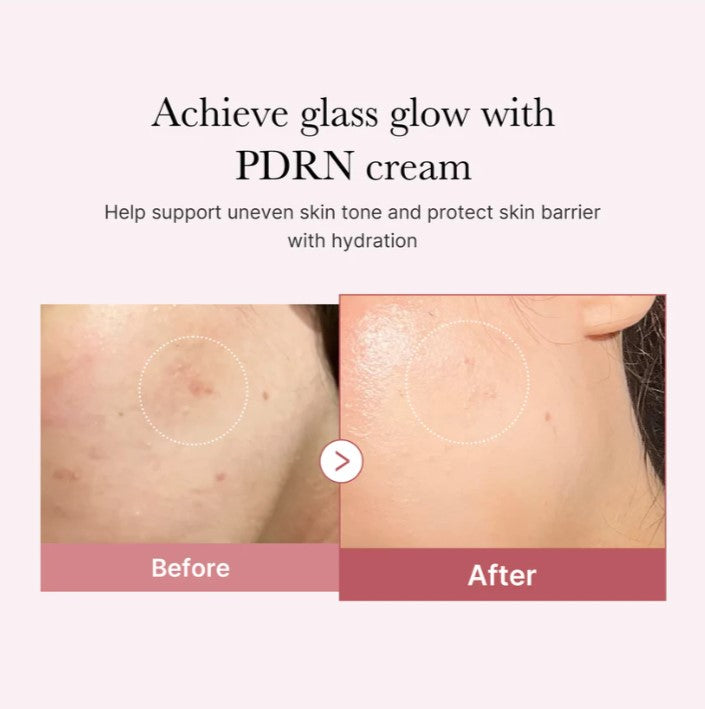 MEDICUBE PDRN Pink Hyaluronic Moisturizing Cream 50ml