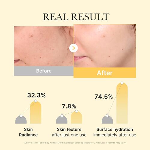 [PRE ORDER] MEDICUBE Kojic Acid Tumeric Brightening Gel Mask 4ea