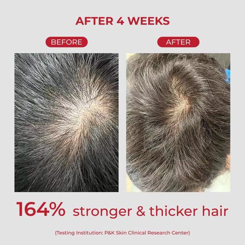 [PRE ORDER] MOEV Annucartin Shampoo 300ml