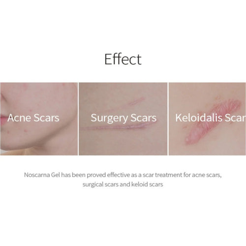 [PRE ORDER] DONG-A PHARM Noscarna Gel 20g | K-Fest Exclusive Price