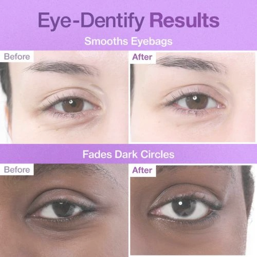 [PRE ORDER] NUMBUZIN No.9 NAD+ Collagen Under Eye Patches 5ea