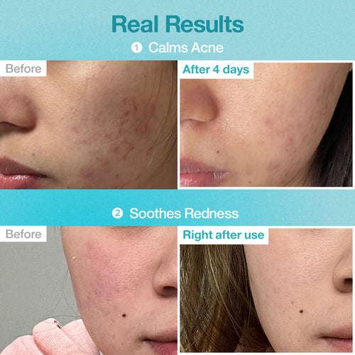 NUMBUZIN Pantothenic B5 Hyaluronic Active Clear Mask