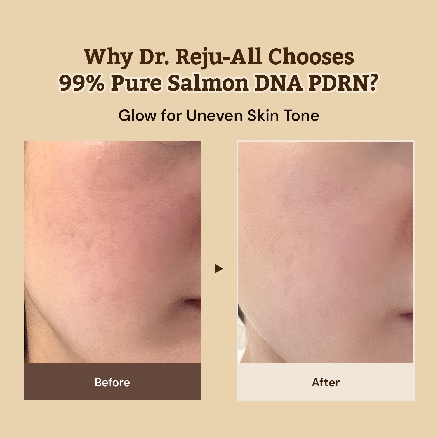 DR.REJU-ALL Advanced PDRN Rejuvenating Cream Max 60ml