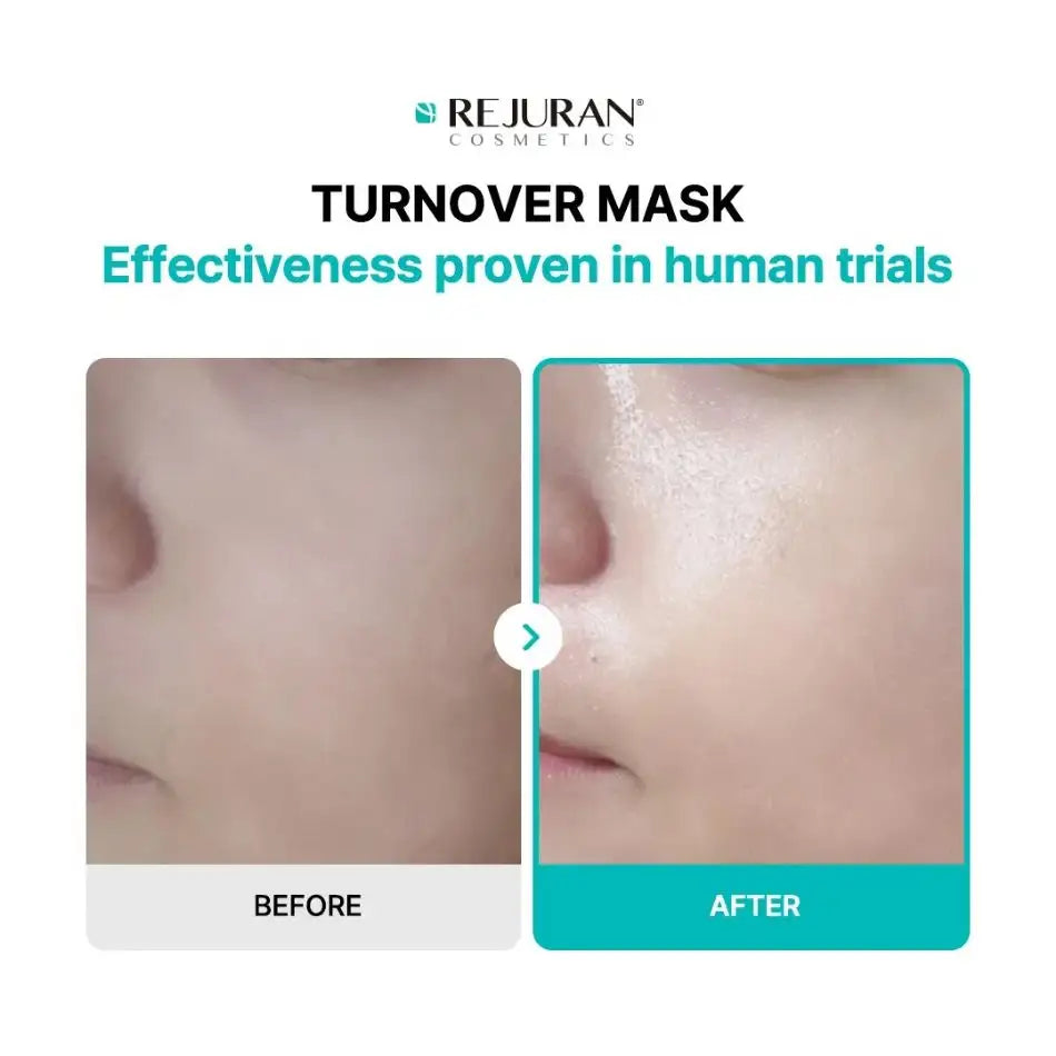 REJURAN Turnover Mask 5ea