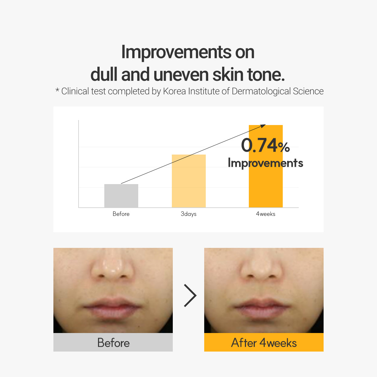 [PRE ORDER] ROVECTIN Vita/Brightening Dark Spot Serum 30ml